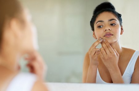 Woman with acne-prone skin looking in a mirror
